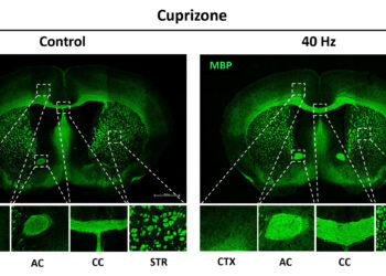 Evidence that 40Hz gamma stimulation promotes brain health is expanding