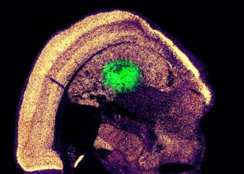MIT engineers turn skin cells directly into neurons for cell therapy