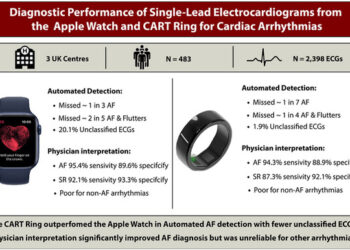 UK Clinical Study Finds Sky Labs’ Smart Ring ‘CART-I’ More Sensitive Than Apple Watch for AFib Detection