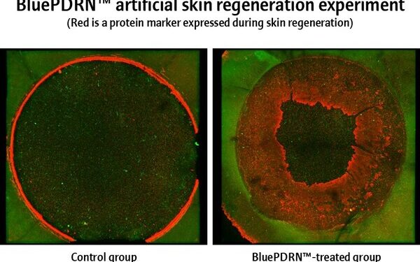 Amorepacific Research Confirms Potential of Microalgal-Derived PDRNs in Skin Regeneration and Wound Healing