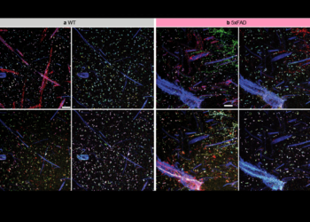 A brief history of expansion microscopy