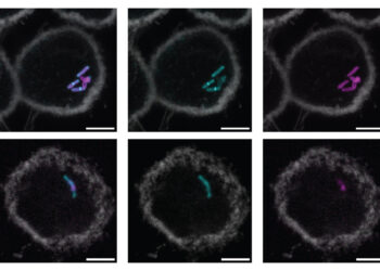 New molecular label could lead to simpler, faster tuberculosis tests