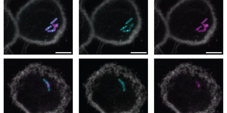 New molecular label could lead to simpler, faster tuberculosis tests