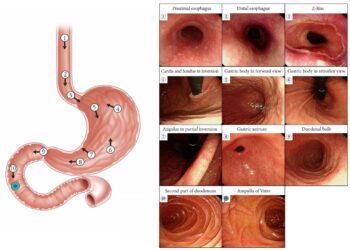 ‘Non-local doctors cut gastroscopy waiting times’