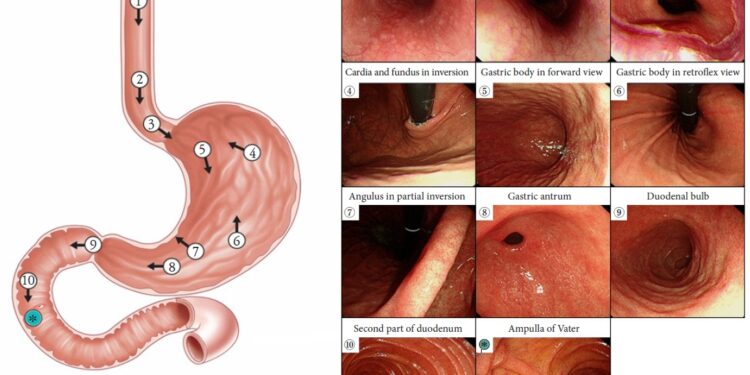 ‘Non-local doctors cut gastroscopy waiting times’