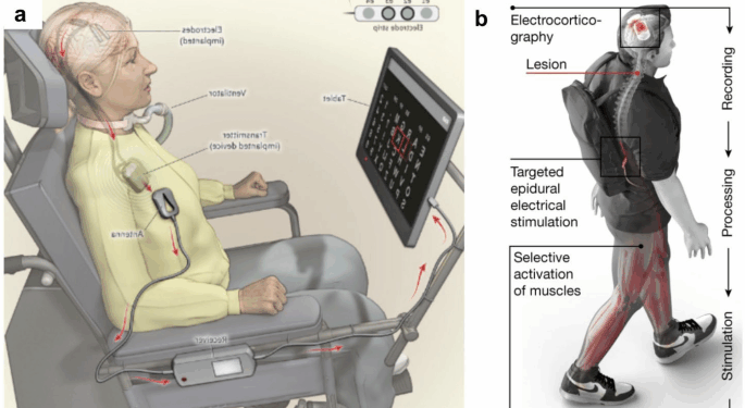 Neural activity helps circuit connections mature into optimal signal transmitters