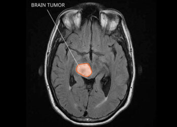 This is your brain without sleep