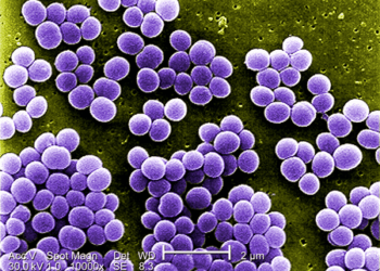 A Cell So Minimal That It Challenges Definitions of Life