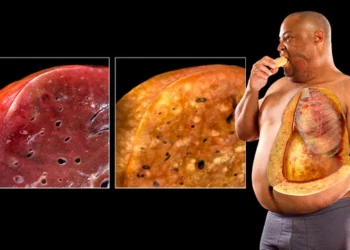 Study: High-fat diets make liver cells more likely to become cancerous