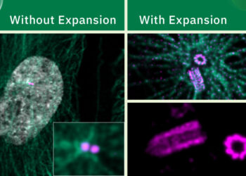 Expansion Microscopy Has Transformed How We See the Cellular World