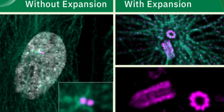 Expansion Microscopy Has Transformed How We See the Cellular World