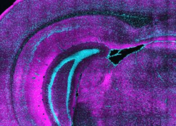 How a unique class of neurons may set the table for brain development