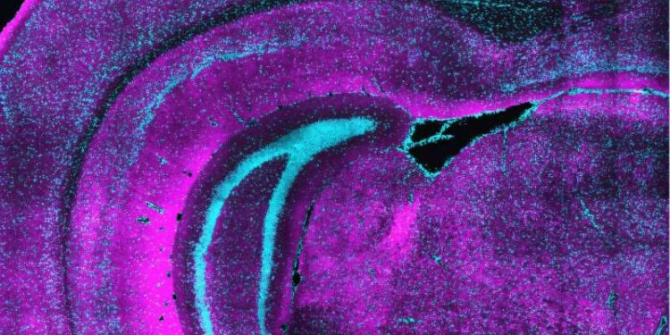 How a unique class of neurons may set the table for brain development