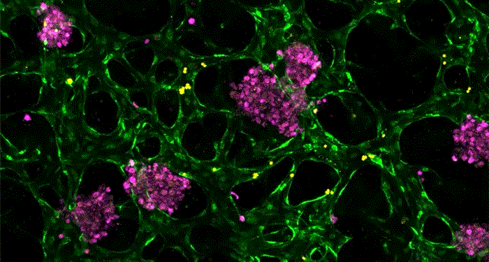 New tissue models could help researchers develop drugs for liver disease