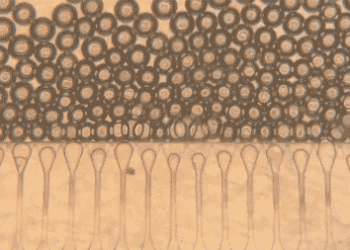 Injectable “satellite livers” could offer an alternative to liver transplantation