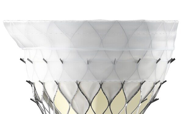 First Implant of KingstronBio’s ProStyle M® Transcatheter Mitral Valve System Successfully Completed in National Multicenter Confirmatory Study