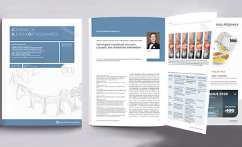 Professor Gang Shen’s Orthodontic Team Publishes Third Consecutive Paper in the Journal of Aligner Orthodontics