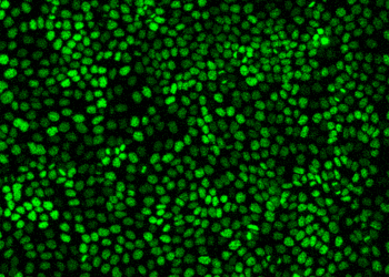 Cells pulse together as they grow — and malignant cells pulse the longest