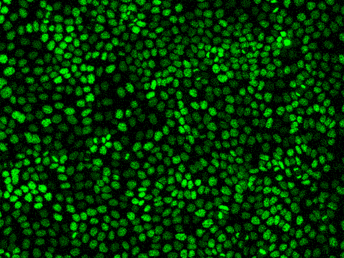 Cells pulse together as they grow — and malignant cells pulse the longest